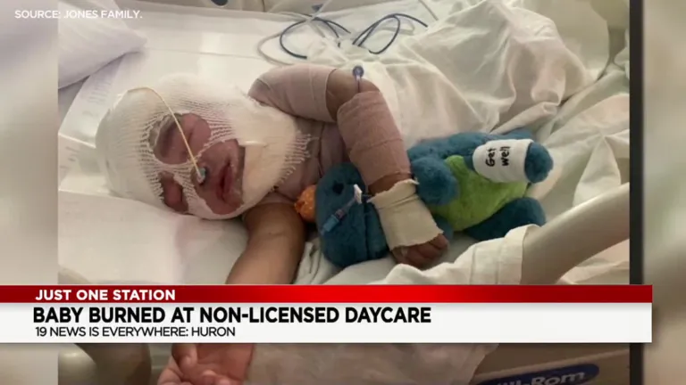 Kid hospitalized with burns after claimed incident at babysitter's home