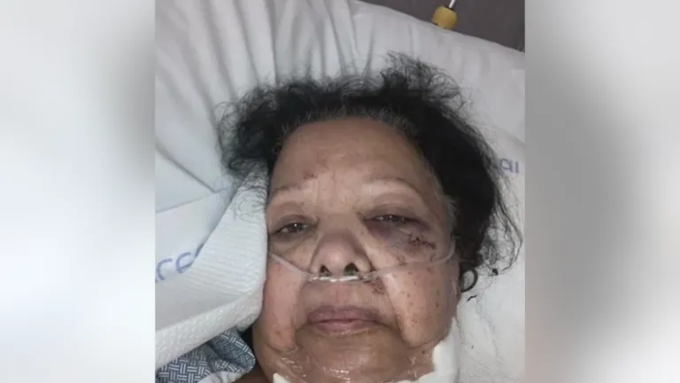 75-year-old speaks out from hospital bed after vicious stabbing at Temple Hills carry out